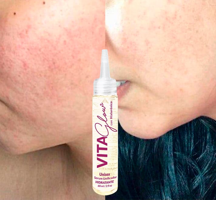 Serum unificador Aclarante Vitaglow 3 frascos
