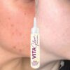 Serum unificador Aclarante Vitaglow 3 frascos