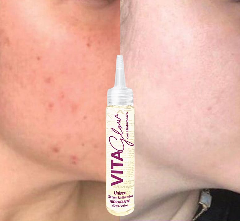 Serum unificador Aclarante Vitaglow 3 frascos