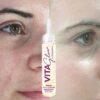 Serum unificador Aclarante Vitaglow 3 frascos